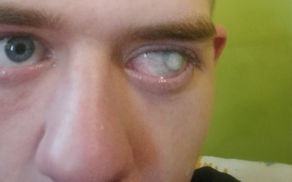 
        Zbiórka Leczenie, konsultacje i operację - zdjęcie główne
    