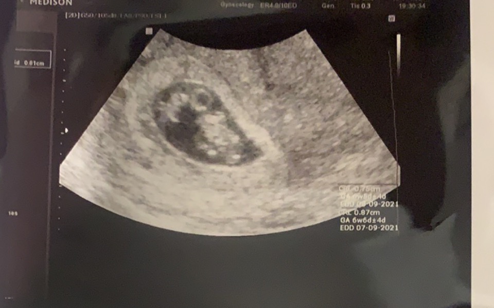 
        Zbiórka Samotna mama robi prawo jazdy - zdjęcie główne
    