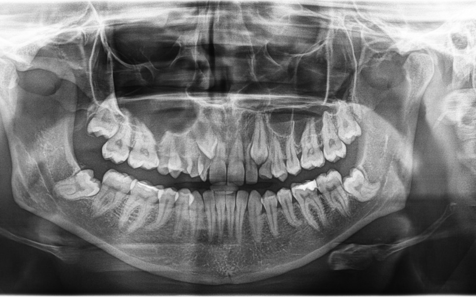 
        Zbiórka Leczenie zębów - ortodoncja - zdjęcie główne
    