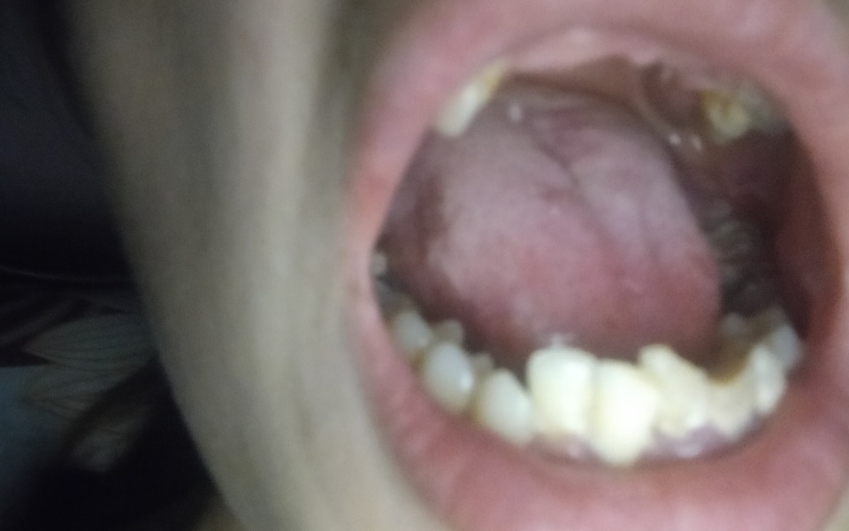 
        Zbiórka Piękny uśmiech młodej mamy - zdjęcie główne
    