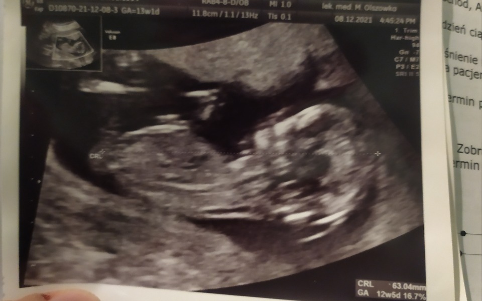 
        Zbiórka Wyprawka dla maleństwa - zdjęcie główne
    