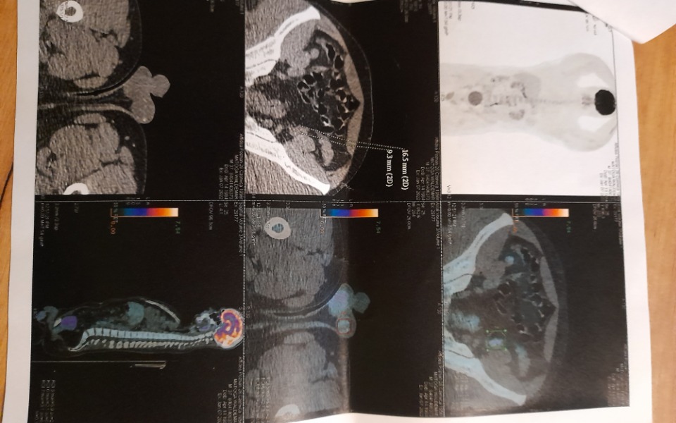 
        Zbiórka Uratuj zycie - zdjęcie główne
    