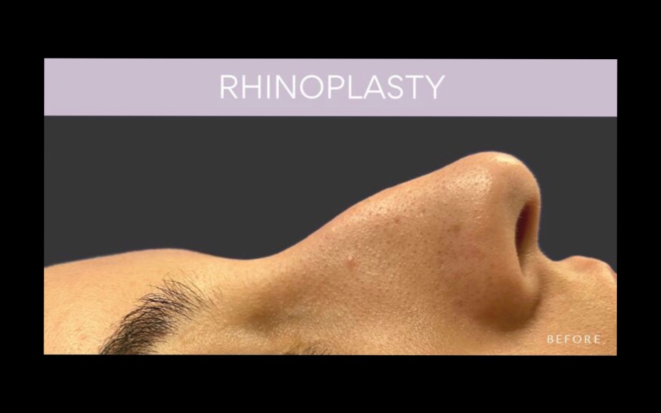 
        Zbiórka Zbieram na operacje nosa - zdjęcie główne
    