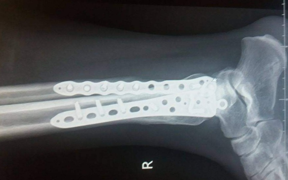 
        Zbiórka Operacja wyciągnięcia zespolenia - zdjęcie główne
    