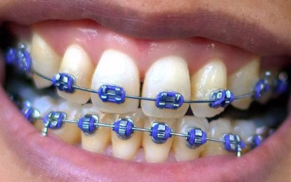 
        Zbiórka Zbiórka dla Piotra - zdjęcie główne
    