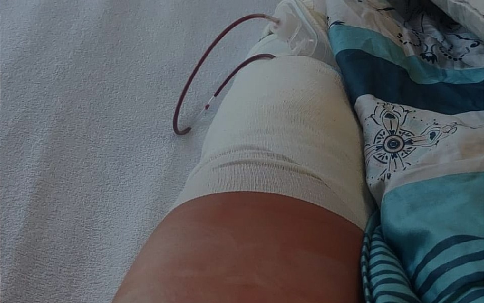 
        Zbiórka Na rehabilitacje po zabiegu - zdjęcie główne
    
