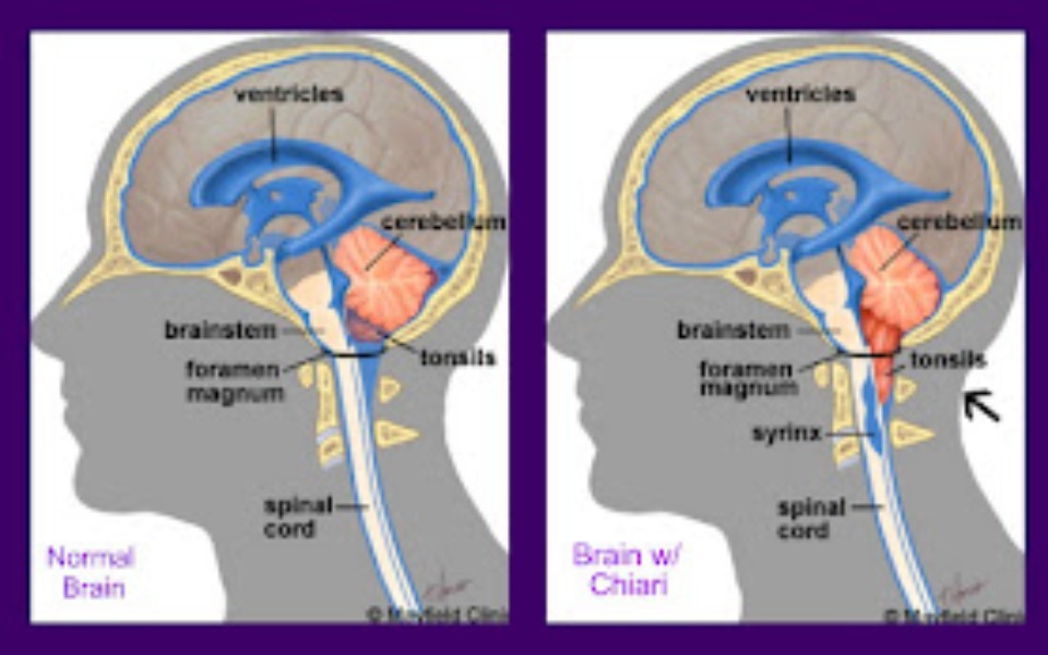 
        Zbiórka Leki i wizyty lekarskie - zdjęcie główne
    