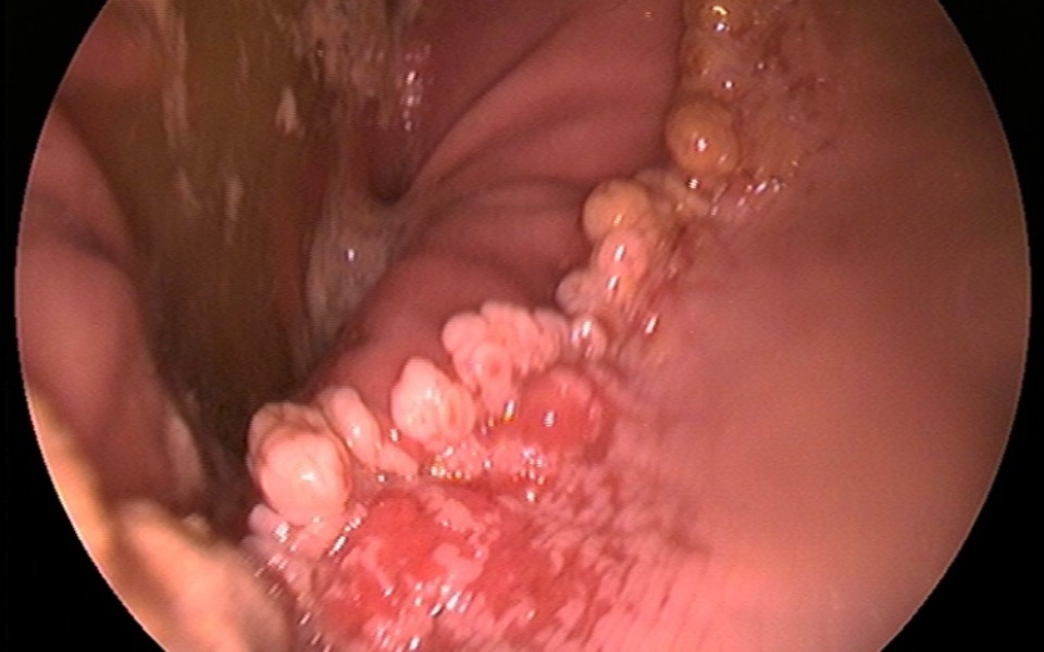 
        Zbiórka Wrzody u przyjaciela - zdjęcie główne
    