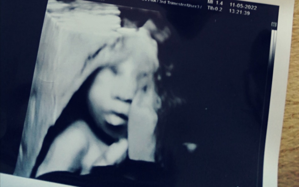 
        Zbiórka Wyprawka / szpital - zdjęcie główne
    