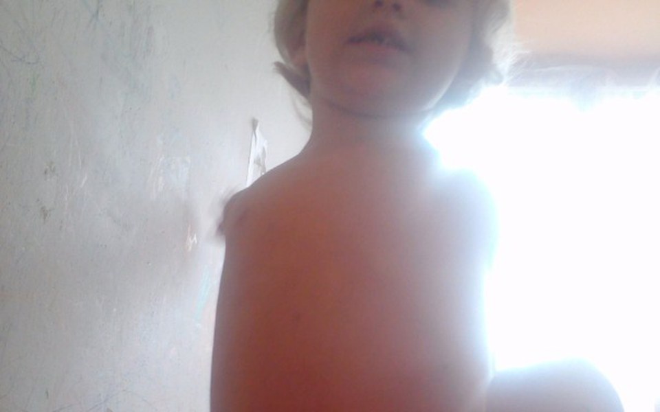 
        Zbiórka Szansa dla Anetka - zdjęcie główne
    