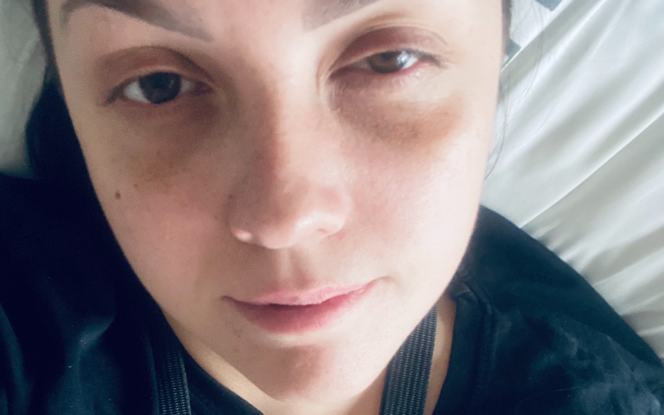 
        Zbiórka Sprawność po udarze - zdjęcie główne
    