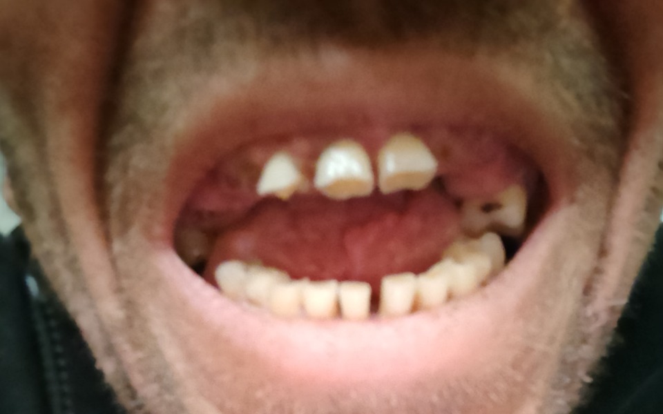 
        Zbiórka Zbieram na zęby moja - zdjęcie główne
    