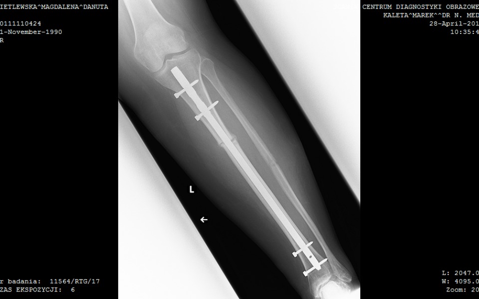 
        Zbiórka Życie z niepełnosprawnością. - zdjęcie główne
    