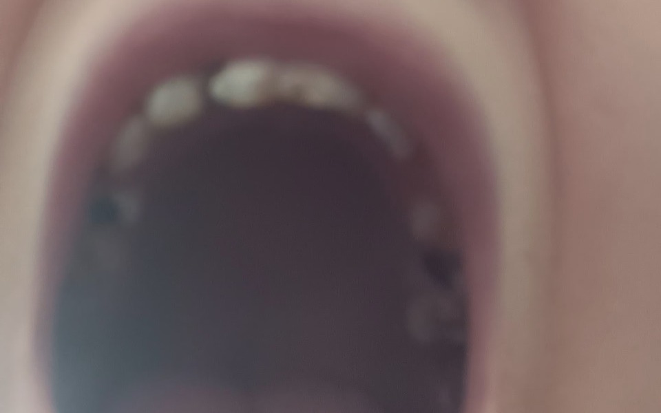 
        Zbiórka Na naprawę zębów i korony - zdjęcie główne
    