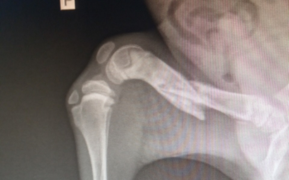 
        Zbiórka Oszukać przeznaczenie... - zdjęcie główne
    