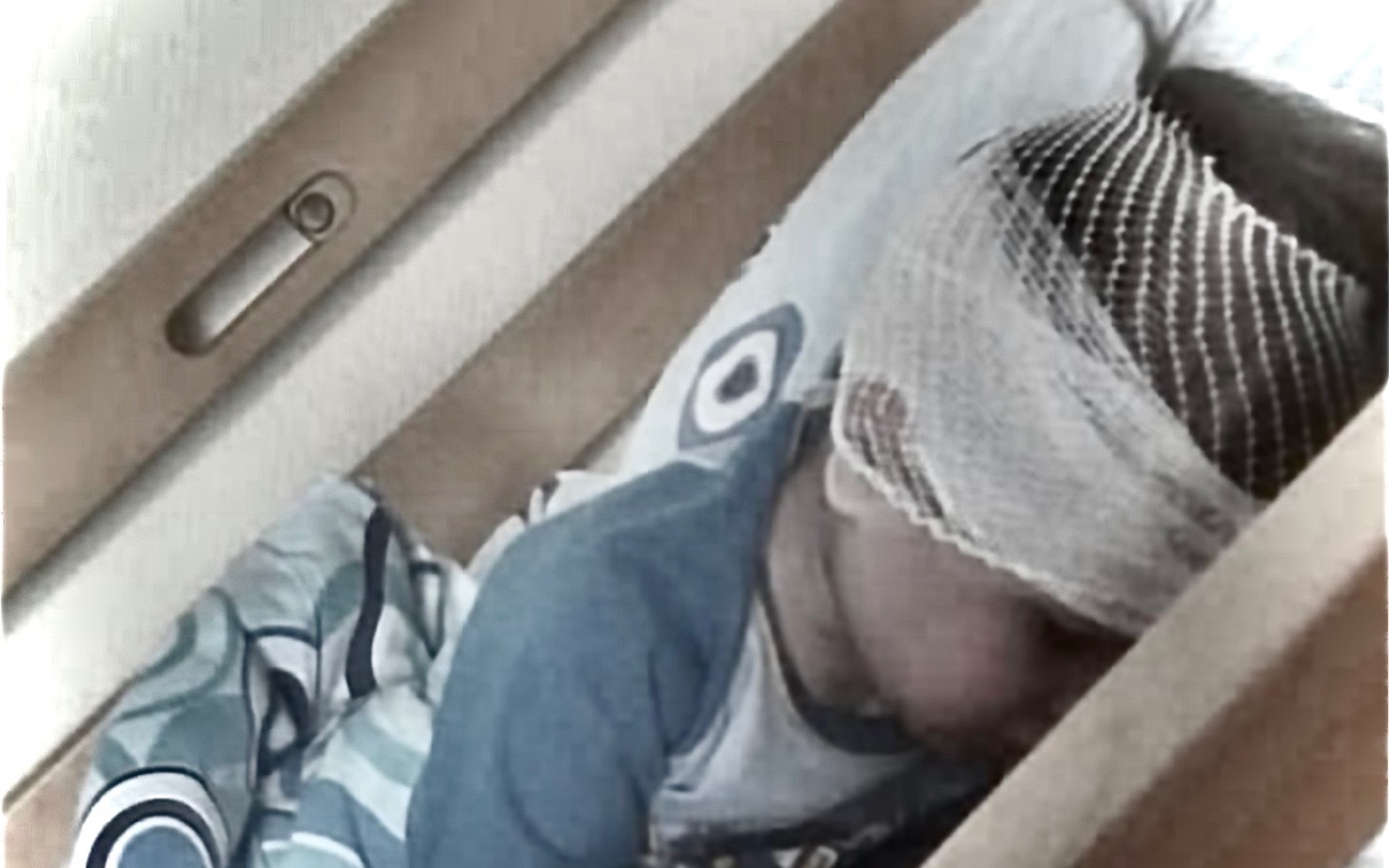 
        Chłopiec śpiący z opatrunkiem na głowie.
    