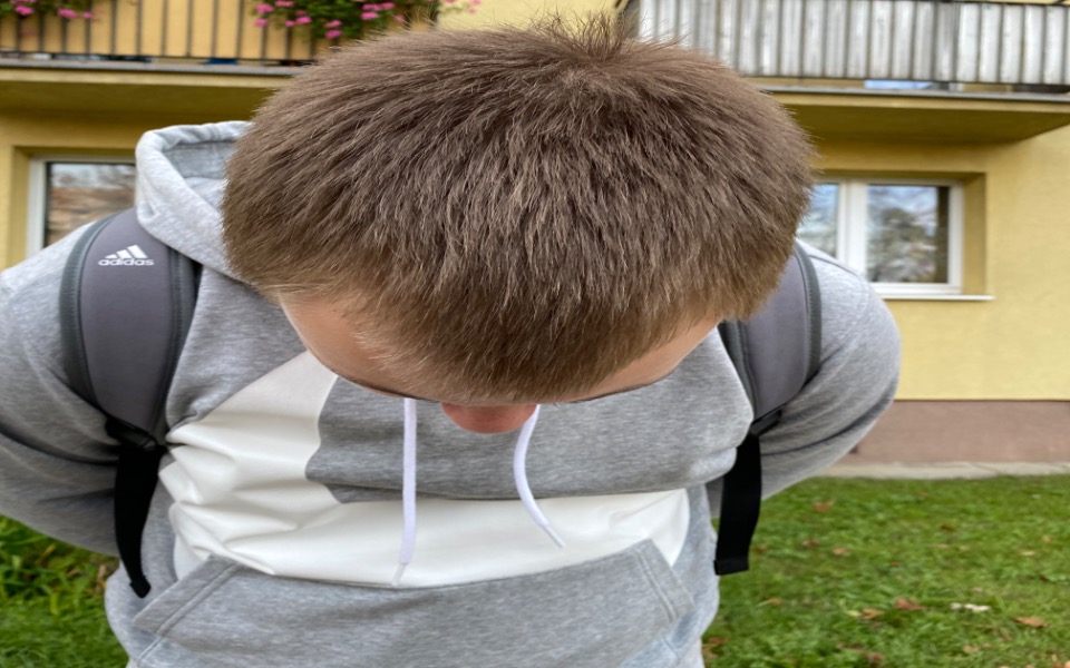 
        Zbiórka Zabieg na przeszczep włosów - zdjęcie główne
    