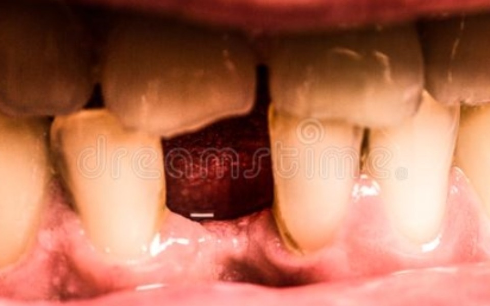 
        Zbiórka Pomóż mi uzbierać na ząb - zdjęcie główne
    