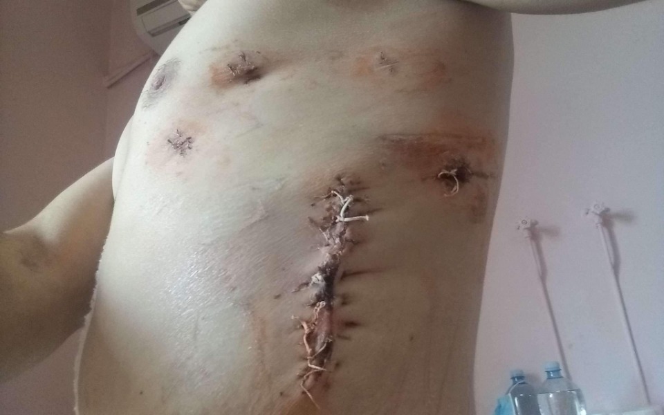 
        Zbiórka Pomoc rannemu - zdjęcie główne
    