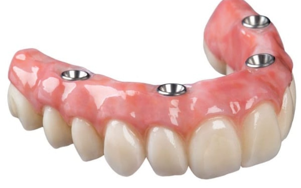 
        Zbiórka Nowy uśmiech. Proteza - zdjęcie główne
    