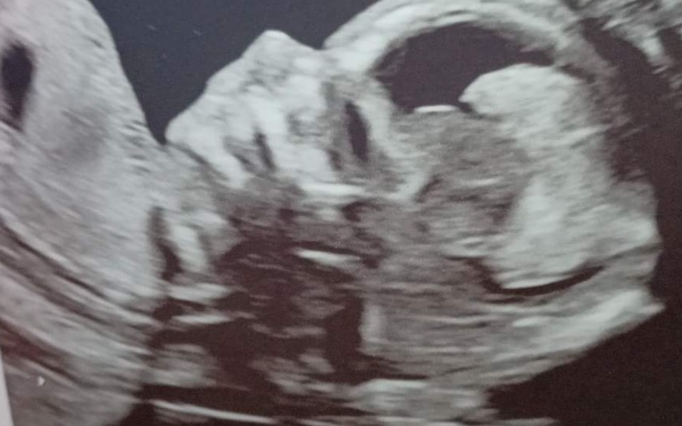 
        Zbiórka Ofiara ataku hakerskiego - zdjęcie główne
    