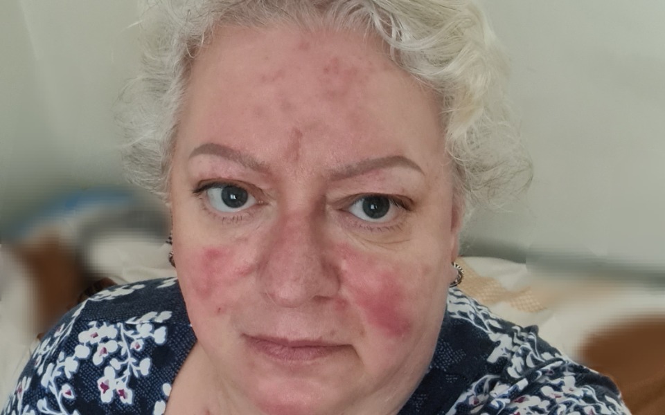 
        Zbiórka Proszę o Pomoc w chorobie. - zdjęcie główne
    