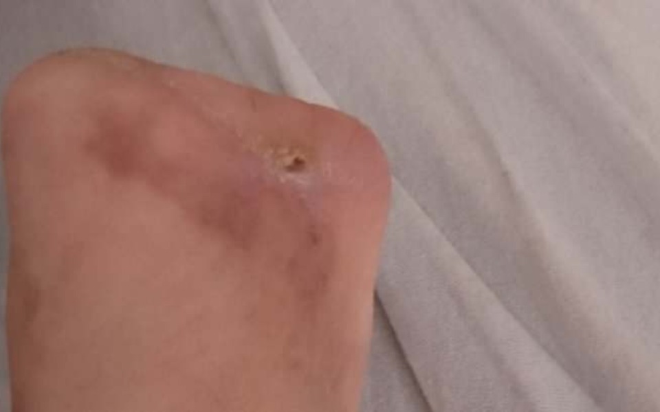 
        Zbiórka Pomóż jeśli masz dobre serce - zdjęcie główne
    