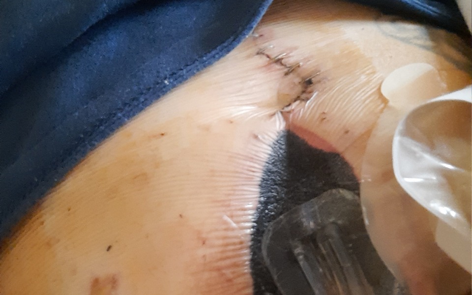 
        Zbiórka Wyjście z choroby nowotworowej - zdjęcie główne
    