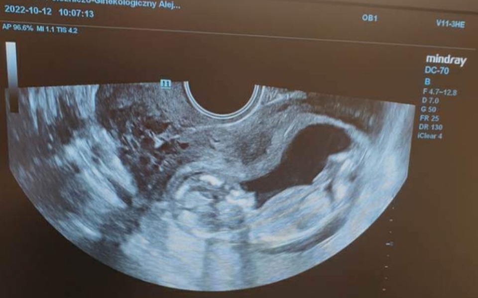 
        Zbiórka Na lepsze życie i nowy start - zdjęcie główne
    