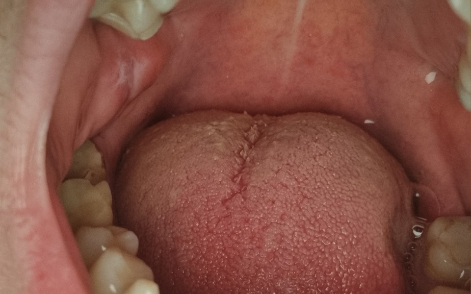 
        Zbiórka Leczenie zębów nowe - zdjęcie główne
    