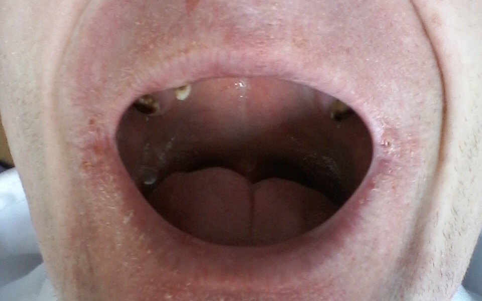 
        Zbiórka PILNIE na cito proteza zębowa - zdjęcie główne
    