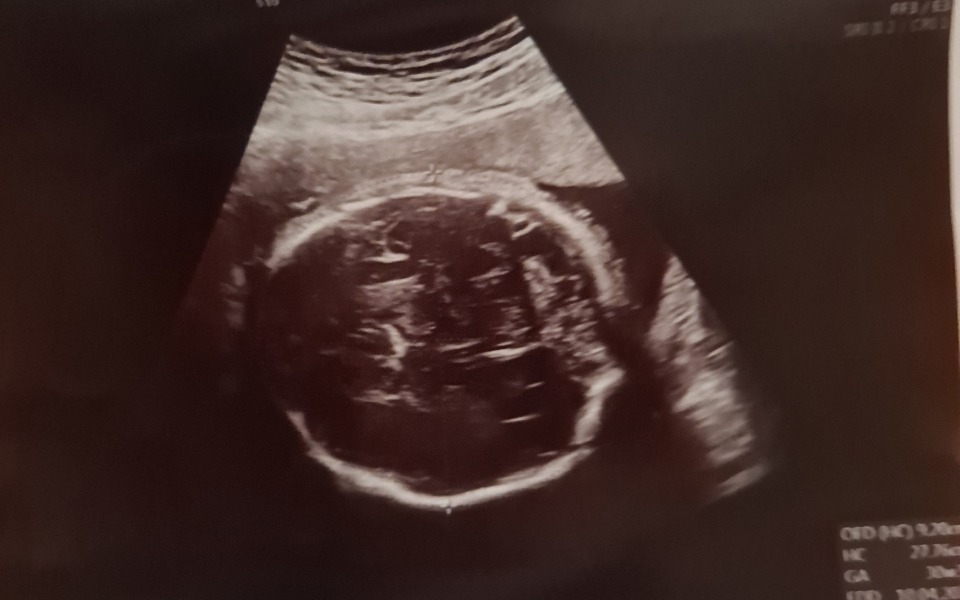 
        Zbiórka Narodziny Synka - zdjęcie główne
    