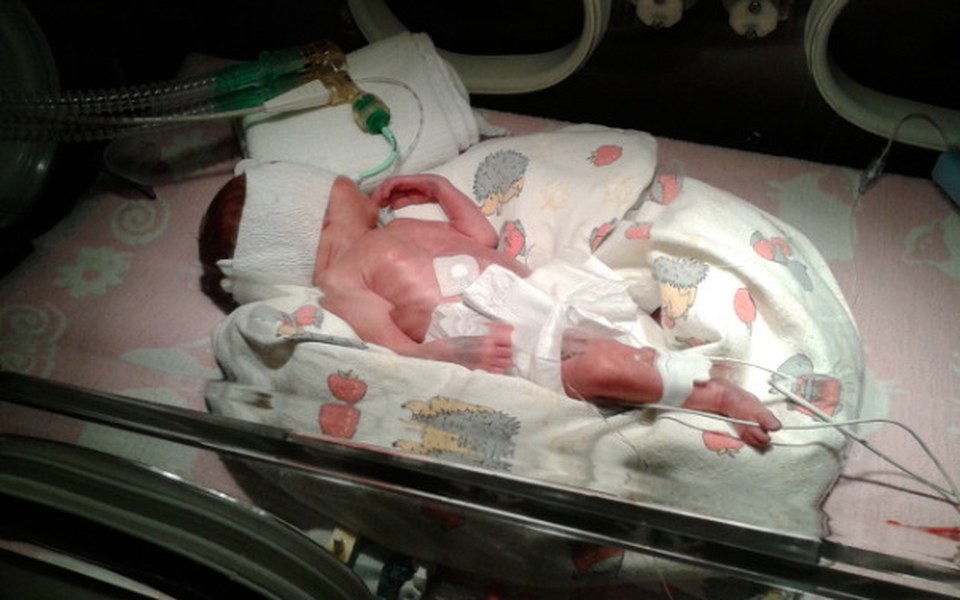 Zbiórka Pomoc w rehabilitacji Ani - zdjęcie główne