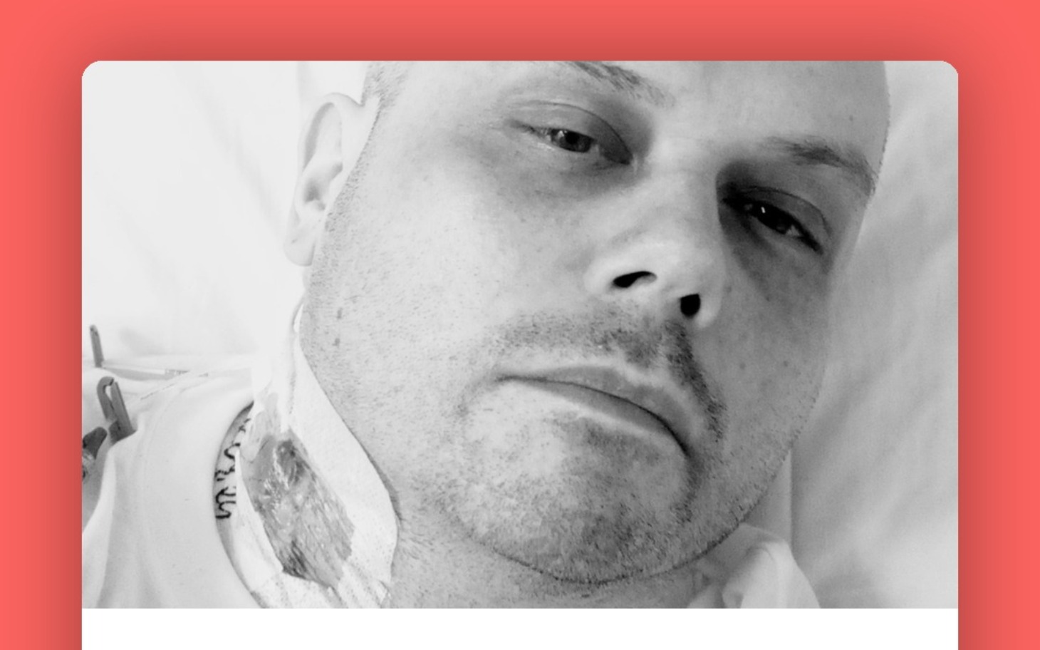 
        Mężczyzna leżący w szpitalnym łóżku, z wyraźnym zmęczeniem na twarzy.
    