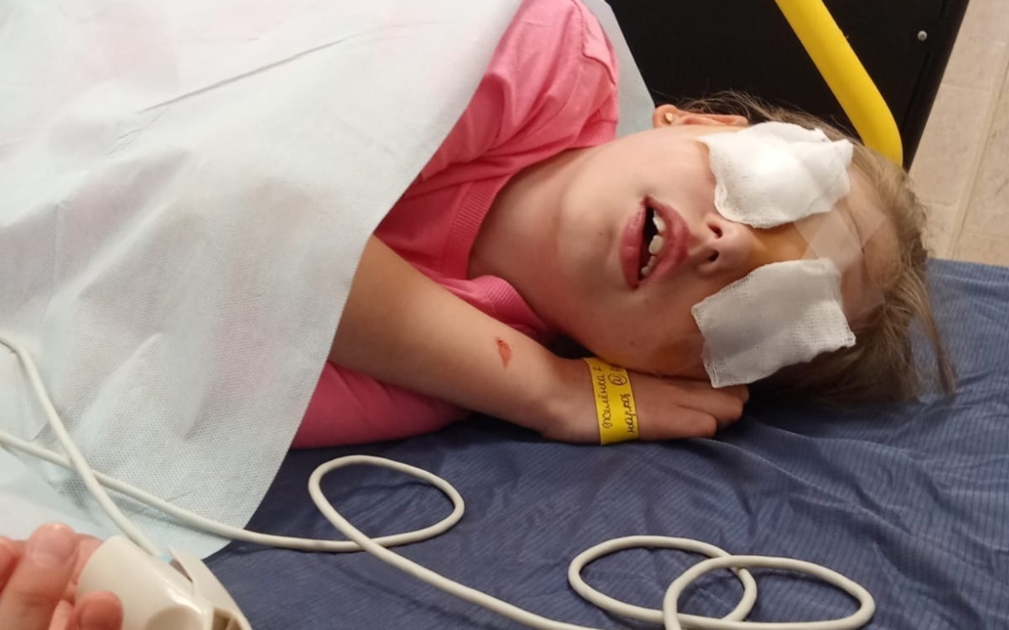 
        Dziecko w szpitalu, z opatrunkami na oczach.
    