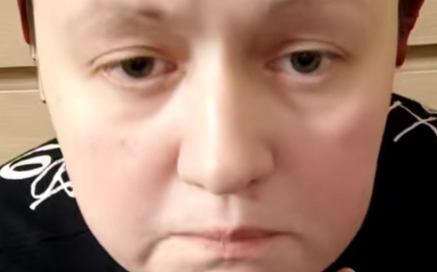 
        Osoba z wyraźnym smutkiem na twarzy, patrząca w kamerę.
    