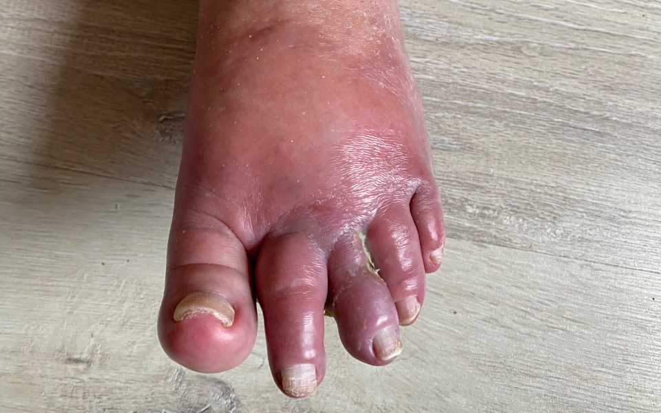 
        Zbiórka Pomóżcie mojej Babciuni - zdjęcie główne
    