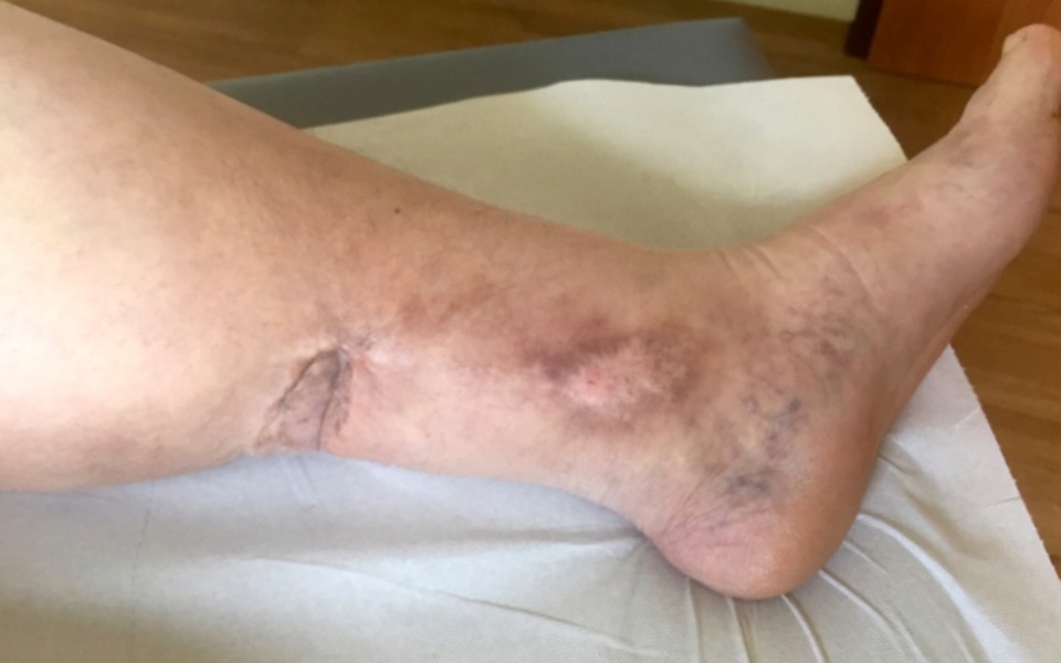 
        Zbiórka Ppomoc w leczeniuu - zdjęcie główne
    