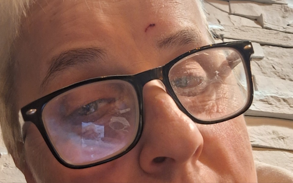 
        Zbiórka Na leczenie Marianny Łaski - zdjęcie główne
    