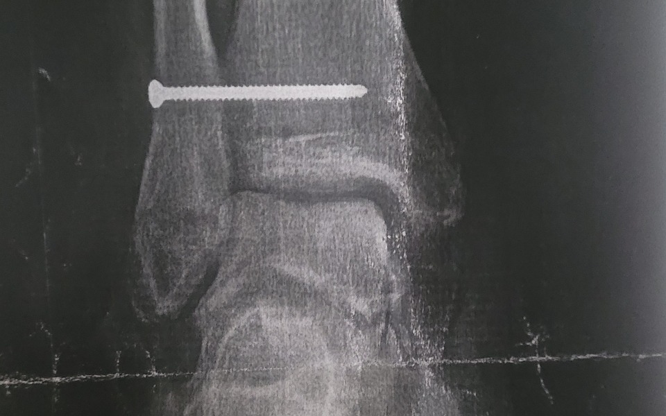 
        Zbiórka Zbiórka na powrót do pracy - zdjęcie główne
    