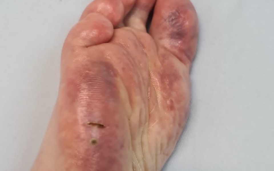 
        Zbiórka Toczeń walka - zdjęcie główne
    