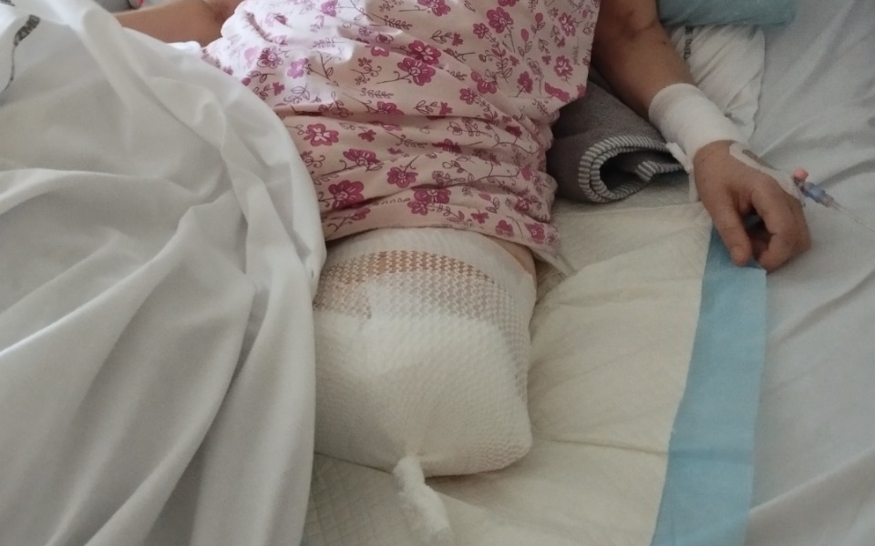 Osoba w łóżku szpitalnym z opatrunkiem na nodze.