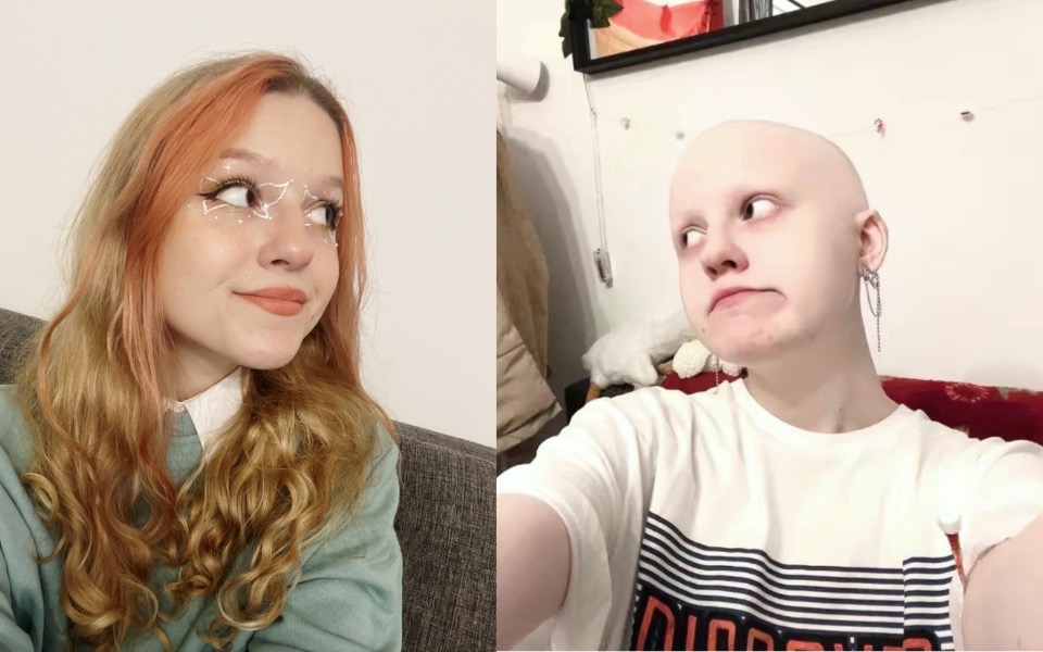 
        Dwie dziewczyny pozujące do zdjęcia, jedna z długimi włosami, druga łysa.
    