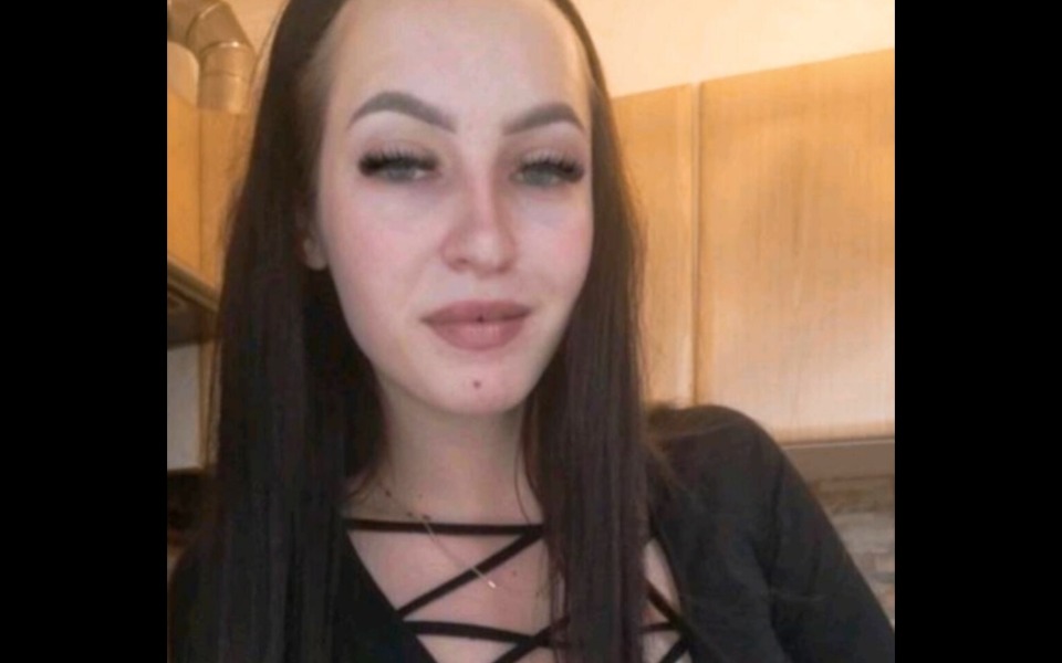 
        Zbiórka Usuniecie żylaków - zdjęcie główne
    