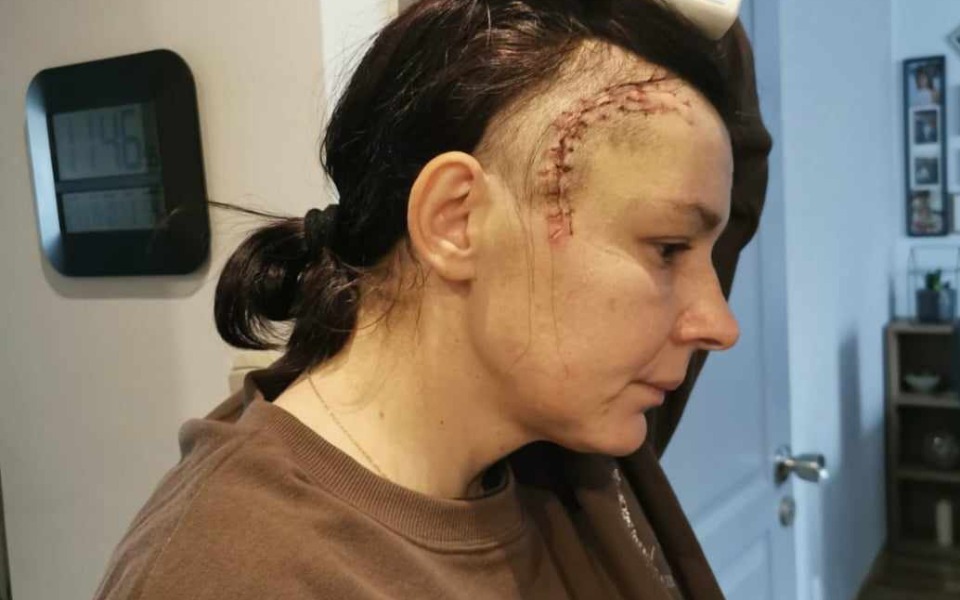 
        Zbiórka Zbieram na potrzeby osoby chorej - zdjęcie główne
    