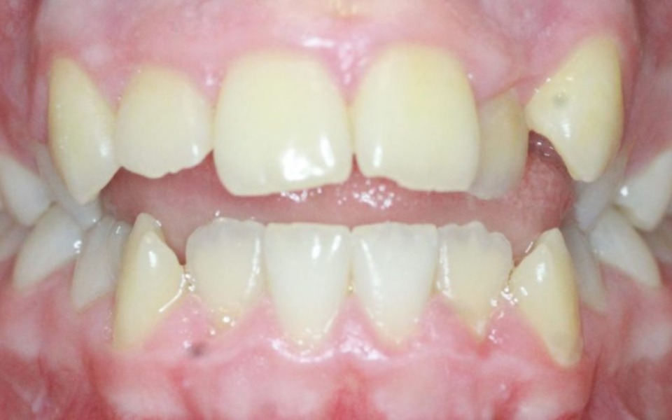 
        Zbiórka Leczenie ortodontyczne zebow - zdjęcie główne
    