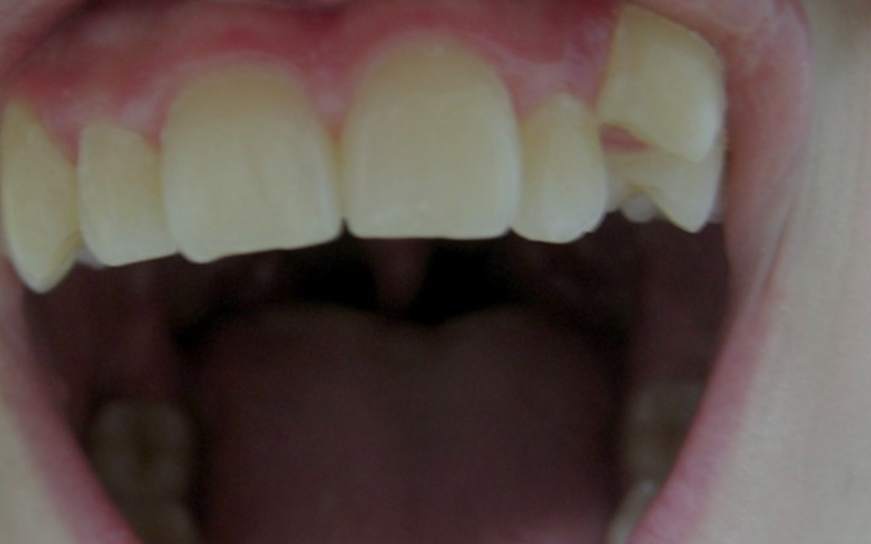 
        Zbiórka leczenie zeba - zdjęcie główne
    