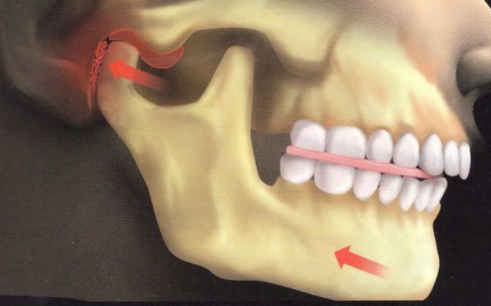 
        Zbiórka Zaburzeń kostno żuchwowych - zdjęcie główne
    