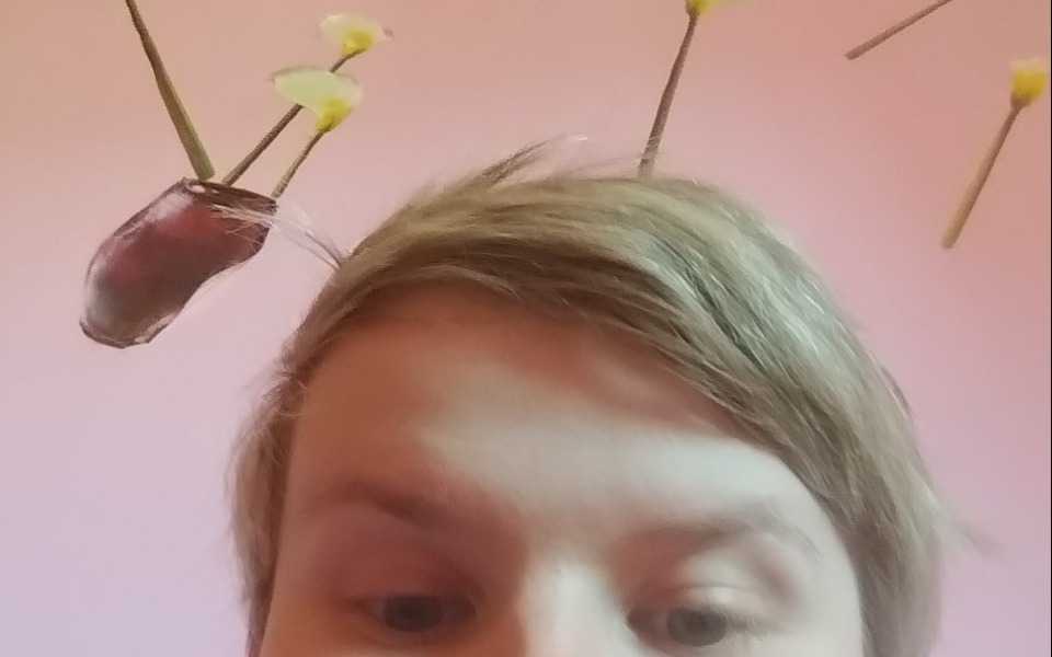 
        Zbiórka Na rechablitacje domowa - zdjęcie główne
    