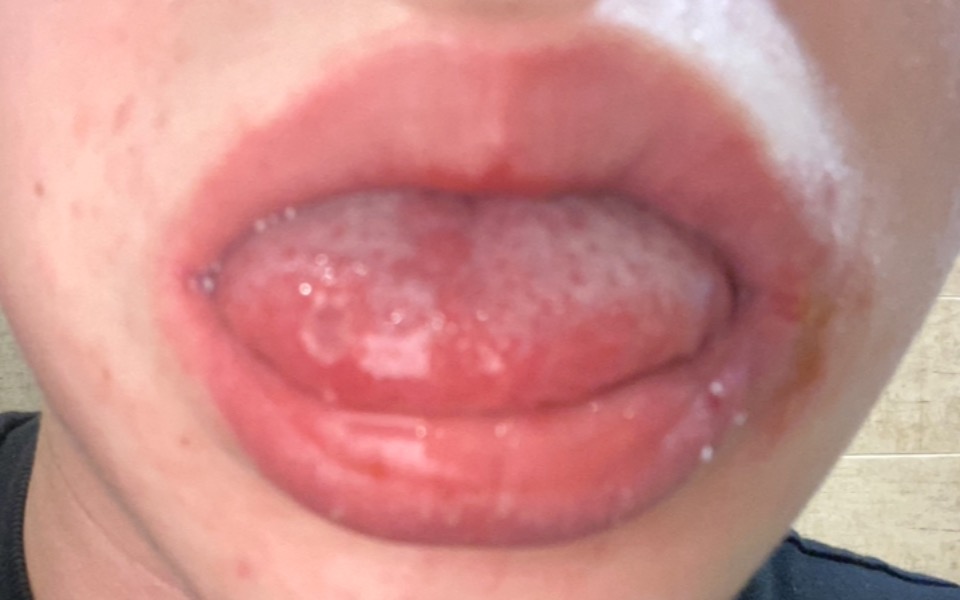 
        Zbiórka Choroba Autoimmunologiczna Kuby - zdjęcie główne
    